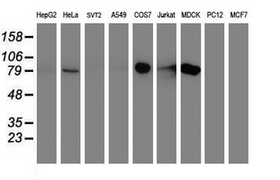 m06354 anti dgka mouse monoclonal antibody clone id oti8g5 wb testing 2