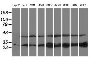 m06357 1 anti pnpo mouse monoclonal antibody clone id oti3b3 wb testing 2
