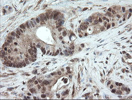 m06357 anti pnpo mouse monoclonal antibody clone id oti1g9 ihc testing 10