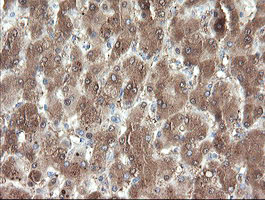 m06357 anti pnpo mouse monoclonal antibody clone id oti1g9 ihc testing 12