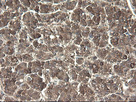 m06357 anti pnpo mouse monoclonal antibody clone id oti1g9 ihc testing 13