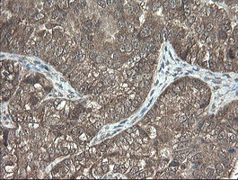 m06357 anti pnpo mouse monoclonal antibody clone id oti1g9 ihc testing 2