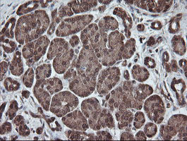 m06357 anti pnpo mouse monoclonal antibody clone id oti1g9 ihc testing 3