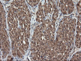 m06357 anti pnpo mouse monoclonal antibody clone id oti1g9 ihc testing 4