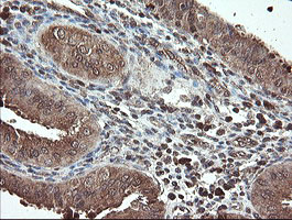 m06357 anti pnpo mouse monoclonal antibody clone id oti1g9 ihc testing 5