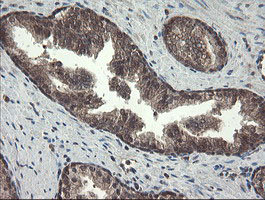 m06357 anti pnpo mouse monoclonal antibody clone id oti1g9 ihc testing 6