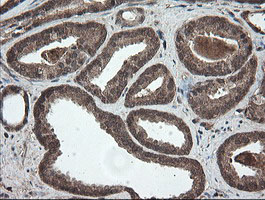 m06357 anti pnpo mouse monoclonal antibody clone id oti1g9 ihc testing 8
