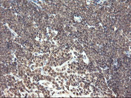 m06357 anti pnpo mouse monoclonal antibody clone id oti1g9 ihc testing 9