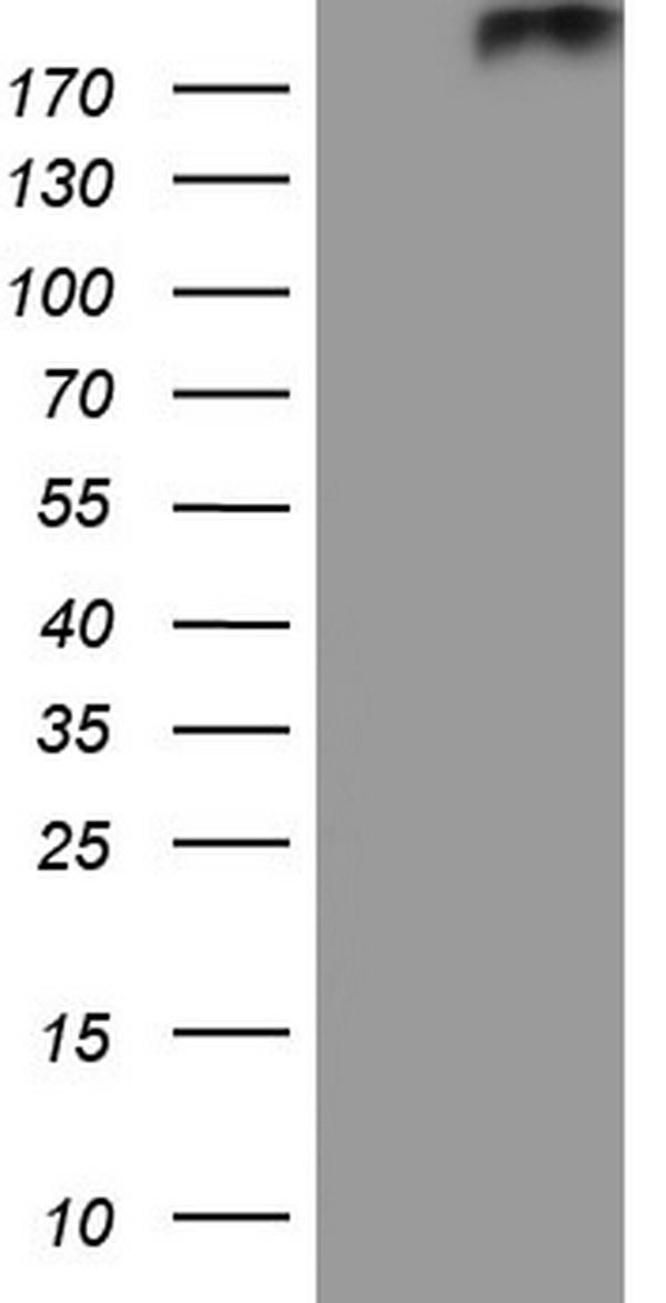 HEK293T cells were transfected with the pCMV6-ENTRY control (Left lane) or pCMV6-ENTRY PTCH2 (Right lane) cDNA for 48 hrs and lysed