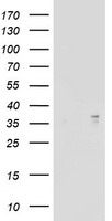 HEK293T cells were transfected with the pCMV6-ENTRY control (Left lane) or pCMV6-ENTRY ART1 (Right lane) cDNA for 48 hrs and lysed