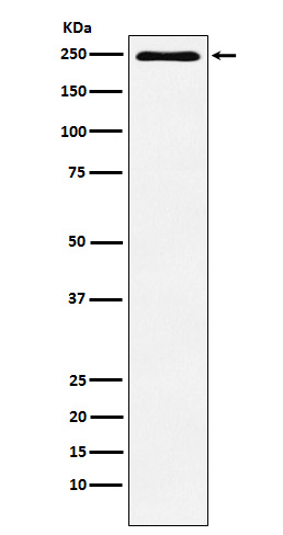 Western blot analysis of Plexin A1 expression in HUVEC cell lysate.