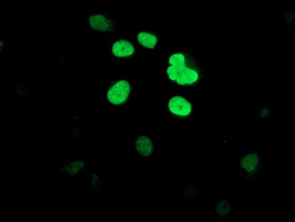m06378 anti dclre1b mouse monoclonal antibody clone id oti2b7 if testing 8