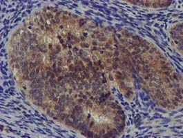 m06378 anti dclre1b mouse monoclonal antibody clone id oti2b7 ihc testing 3
