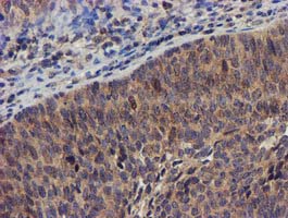 m06378 anti dclre1b mouse monoclonal antibody clone id oti2b7 ihc testing 4