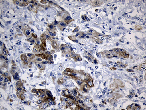 m06387 anti cisd2 mouse monoclonal antibody clone id oti4d12 ihc testing 4