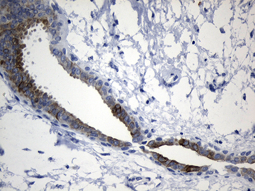 m06387 anti cisd2 mouse monoclonal antibody clone id oti4d12 ihc testing 5