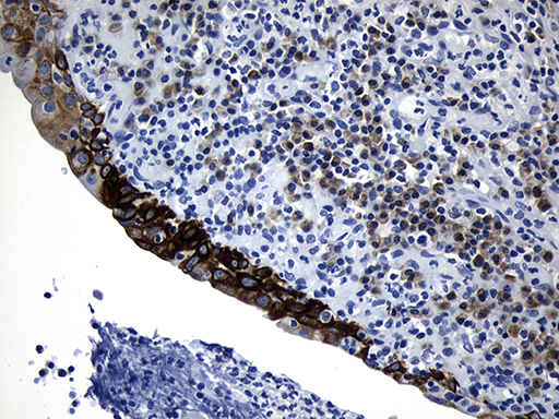 m06387 anti cisd2 mouse monoclonal antibody clone id oti4d12 ihc testing 6