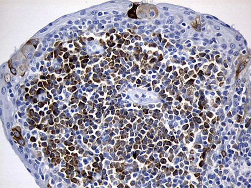 m06387 anti cisd2 mouse monoclonal antibody clone id oti4d12 ihc testing 7