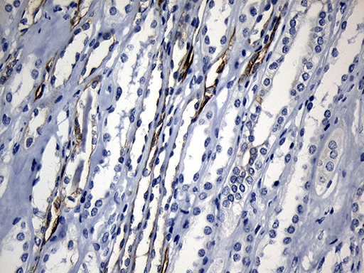 m06387 anti cisd2 mouse monoclonal antibody clone id oti4d12 ihc testing 8