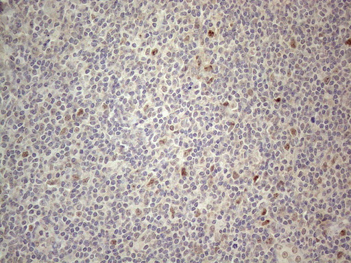 m06400 anti cnot2 mouse monoclonal antibody clone id oti5a12 ihc testing 5