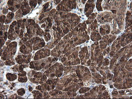 m06401 1 anti carboxypeptidase a2 cpa2 mouse monoclonal antibody clone id oti3d8 ihc testing 4