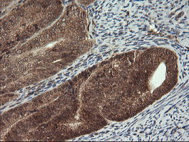 m06401 1 anti carboxypeptidase a2 cpa2 mouse monoclonal antibody clone id oti3d8 ihc testing 5