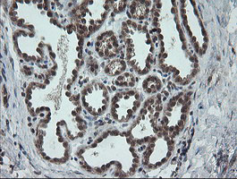 m06401 1 anti carboxypeptidase a2 cpa2 mouse monoclonal antibody clone id oti3d8 ihc testing 6