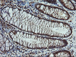 m06401 1 anti carboxypeptidase a2 cpa2 mouse monoclonal antibody clone id oti3d8 ihc testing 7