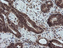 m06401 1 anti carboxypeptidase a2 cpa2 mouse monoclonal antibody clone id oti3d8 ihc testing 8