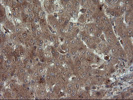 m06401 1 anti carboxypeptidase a2 cpa2 mouse monoclonal antibody clone id oti3d8 ihc testing 9