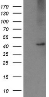 HEK293T cells were transfected with the pCMV6-ENTRY control (Left lane) or pCMV6-ENTRY CPA2 (Right lane) cDNA for 48 hrs and lysed