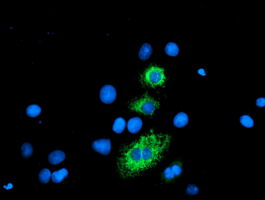 m06401 anti carboxypeptidase a2 cpa2 mouse monoclonal antibody clone id oti1c7 if testing 12