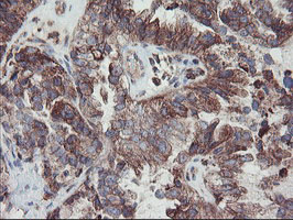 m06401 anti carboxypeptidase a2 cpa2 mouse monoclonal antibody clone id oti1c7 ihc testing 2
