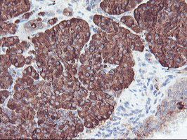 m06401 anti carboxypeptidase a2 cpa2 mouse monoclonal antibody clone id oti1c7 ihc testing 3