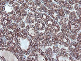 m06401 anti carboxypeptidase a2 cpa2 mouse monoclonal antibody clone id oti1c7 ihc testing 4