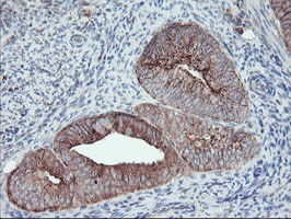 m06401 anti carboxypeptidase a2 cpa2 mouse monoclonal antibody clone id oti1c7 ihc testing 5