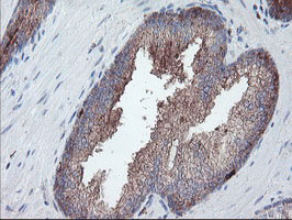 m06401 anti carboxypeptidase a2 cpa2 mouse monoclonal antibody clone id oti1c7 ihc testing 6