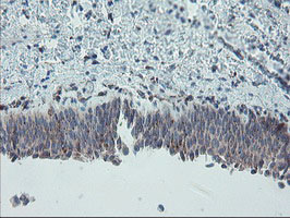 m06401 anti carboxypeptidase a2 cpa2 mouse monoclonal antibody clone id oti1c7 ihc testing 7