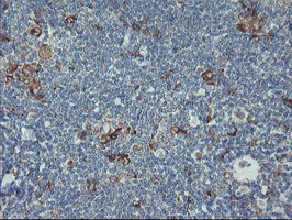 m06401 anti carboxypeptidase a2 cpa2 mouse monoclonal antibody clone id oti1c7 ihc testing 8