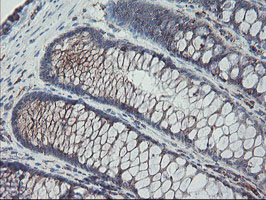 m06401 anti carboxypeptidase a2 cpa2 mouse monoclonal antibody clone id oti1c7 ihc testing 9