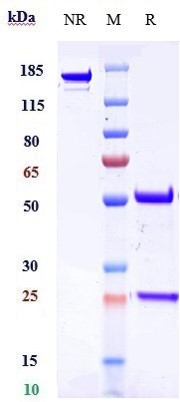 Anti-Dysadherin Reference Antibody (Centrose patent anti-dysadherin) on SDS-PAGE under reducing (R) condition