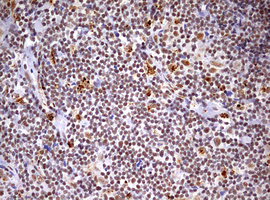 m06430 anti cdca7l mouse monoclonal antibody clone id oti3b5 ihc testing 4
