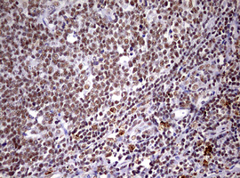 m06430 anti cdca7l mouse monoclonal antibody clone id oti3b5 ihc testing 5