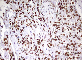 m06430 anti cdca7l mouse monoclonal antibody clone id oti3b5 ihc testing 6