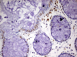 m06430 anti cdca7l mouse monoclonal antibody clone id oti3b5 ihc testing 7