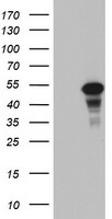 HEK293T cells were transfected with the pCMV6-ENTRY control (Left lane) or pCMV6-ENTRY CDCA7L (Right lane) cDNA for 48 hrs and lysed