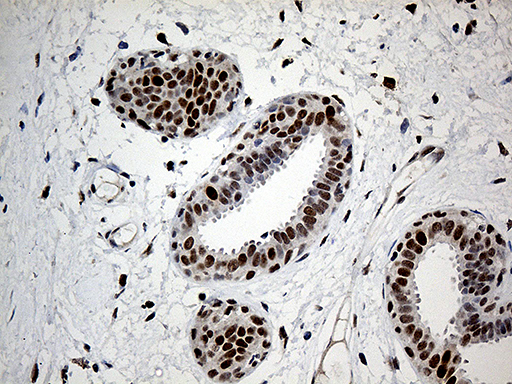 m06442 anti rfc3 mouse monoclonal antibody clone id oti1c7 ihc testing 3