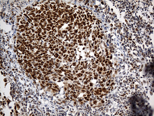 m06442 anti rfc3 mouse monoclonal antibody clone id oti1c7 ihc testing 4
