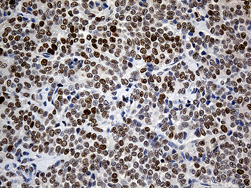 m06442 anti rfc3 mouse monoclonal antibody clone id oti1c7 ihc testing 5