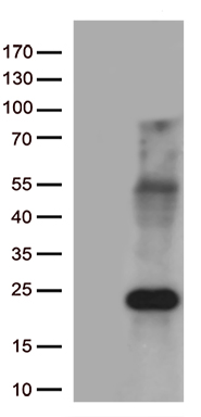 HEK293T cells were transfected with the pCMV6-ENTRY control (Left lane) or pCMV6-ENTRY MYL9 (Right lane) cDNA for 48 hrs and lysed